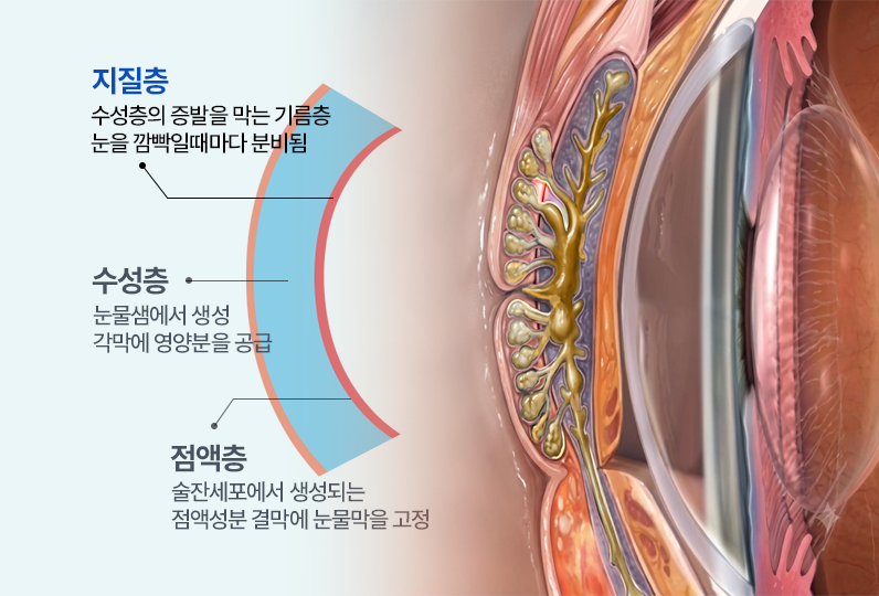 마이봄샘 질환