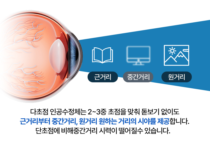 2중초점 설명 이미지