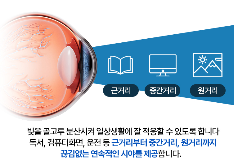 연속초점 설명 이미지