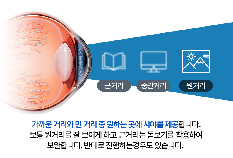 단초점 설명 이미지