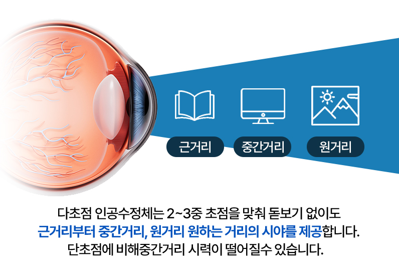 3중초점 설명 이미지