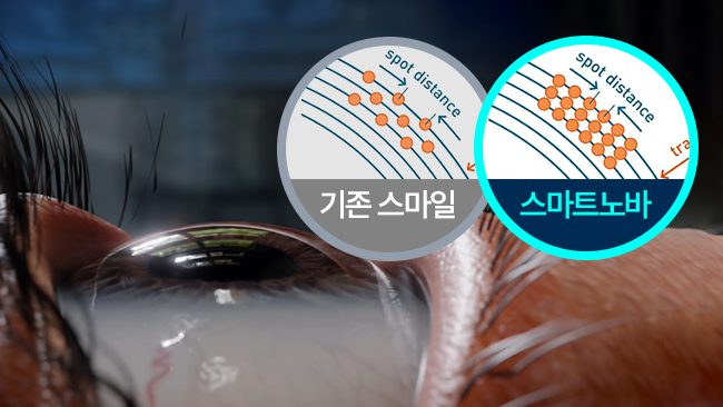 대칭 스팟배열